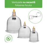 Ventuze din plastic cu vid | fără flacară cu pompă | set 14 buc sau 24 buc | HABYS