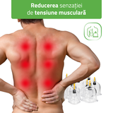 Ventuze din plastic cu vid | fără flacară cu pompă | set 14 buc sau 24 buc | HABYS