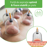 Ventuze din plastic cu vid | fără flacară cu pompă | set 14 buc sau 24 buc | HABYS
